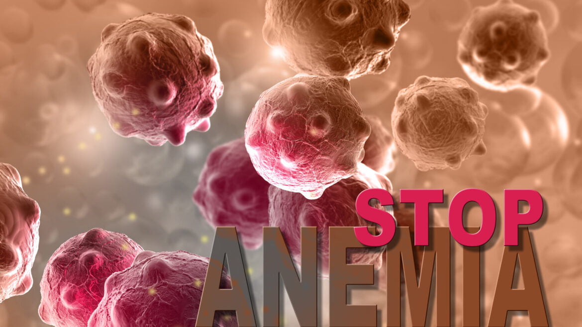 Anemia – co jeść, by uzupełnić niedobory i czego unikać